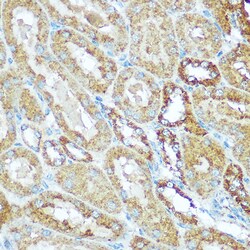 Invitrogen COX5B Polyclonal Antibody 100 &mu;L; Unconjugated:Antibodies,