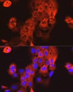 Invitrogen Cytokeratin 15 Polyclonal Antibody 100 &mu;L; Unconjugated:Antibodies,