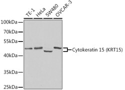 Invitrogen Cytokeratin 15 Polyclonal Antibody 100 &mu;L; Unconjugated:Antibodies,