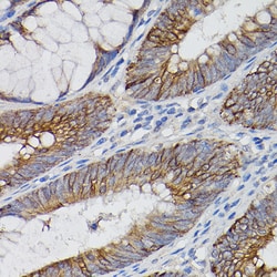 Invitrogen IL-18Ra Polyclonal Antibody 100 &mu;L | Buy Online | Invitrogen&trade; | Fisher Scientific