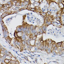 Invitrogen IL-18Ra Polyclonal Antibody 100 &mu;L | Buy Online | Invitrogen&trade; | Fisher Scientific