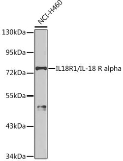 Invitrogen IL-18Ra Polyclonal Antibody 100 &mu;L | Buy Online | Invitrogen&trade; | Fisher Scientific