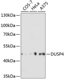 Invitrogen MKP2 Polyclonal Antibody 100 &mu;L; Unconjugated:Antibodies,