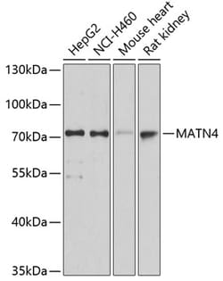 Invitrogen MATN4 Polyclonal Antibody 100 &mu;L; Unconjugated:Antibodies,