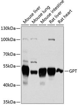 Invitrogen GPT Polyclonal Antibody 100 &mu;L; Unconjugated:Antibodies,