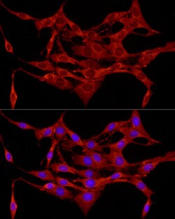 Protein APC Polyclonal Antibody, Invitrogen 100 &mu;L; Unconjugated:Antikörper