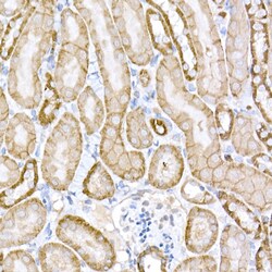 Protein APC Polyclonal Antibody, Invitrogen 100 &mu;L; Unconjugated:Antikörper