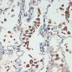 Protein APC Polyclonal Antibody, Invitrogen 100 &mu;L; Unconjugated:Antikörper