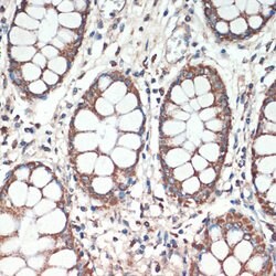 Protein APC Polyclonal Antibody, Invitrogen 100 &mu;L; Unconjugated:Antikörper