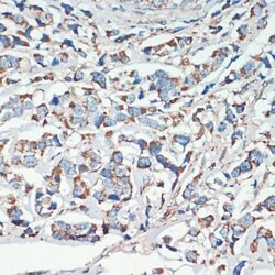Protein APC Polyclonal Antibody, Invitrogen 100 &mu;L; Unconjugated:Antikörper