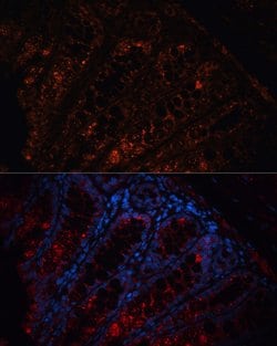 Protein APC Polyclonal Antibody, Invitrogen 100 &mu;L; Unconjugated:Antikörper