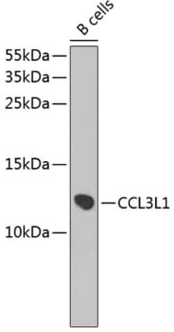 Invitrogen CCL3L1 Polyclonal Antibody 100 &mu;L; Unconjugated:Antibodies,