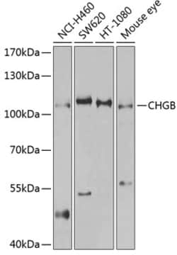 Chromogranin B Polyclonal Antibody:Antibodies, Polyclonal