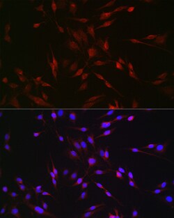 Invitrogen EDA Polyclonal Antibody 100 &mu;L; Unconjugated:Antibodies,