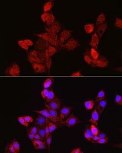 Invitrogen EDA Polyclonal Antibody 100 &mu;L; Unconjugated:Antibodies,