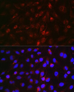 Invitrogen EDA Polyclonal Antibody 100 &mu;L; Unconjugated:Antibodies,