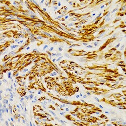 Invitrogen EDA Polyclonal Antibody 100 &mu;L; Unconjugated:Antibodies,