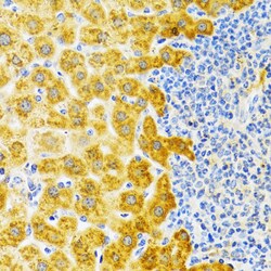 Invitrogen EDA Polyclonal Antibody 100 &mu;L; Unconjugated:Antibodies,