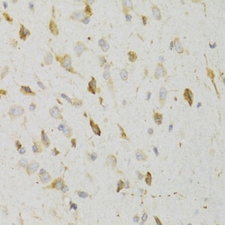 Invitrogen KISS1R Polyclonal Antibody 100 &mu;L; Unconjugated:Antibodies,