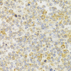 Invitrogen KISS1R Polyclonal Antibody 100 &mu;L; Unconjugated:Antibodies,