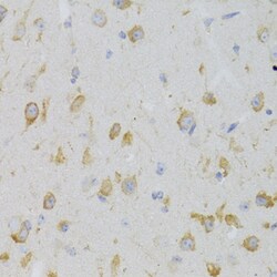 Invitrogen KISS1R Polyclonal Antibody 100 &mu;L; Unconjugated:Antibodies,