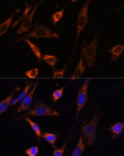 Invitrogen CKMT1B Polyclonal Antibody 100 &mu;L; Unconjugated:Antibodies,