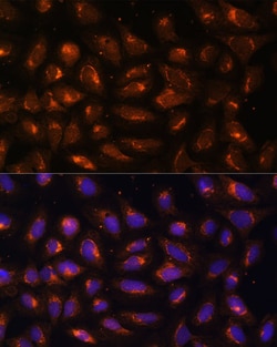 Invitrogen CKMT1B Polyclonal Antibody 100 &mu;L; Unconjugated:Antibodies,