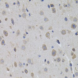 Invitrogen SUMO-3 Polyclonal Antibody 100 &mu;L | Buy Online | Invitrogen&trade; | Fisher Scientific