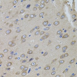 Invitrogen SUMO-3 Polyclonal Antibody 100 &mu;L | Buy Online | Invitrogen&trade; | Fisher Scientific
