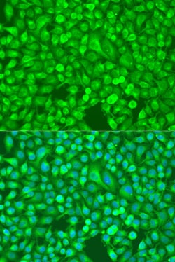 Invitrogen NFkB p100 Polyclonal Antibody 100 &mu;L; Unconjugated:Antibodies,