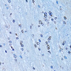 Invitrogen NFkB p100 Polyclonal Antibody 100 &mu;L; Unconjugated:Antibodies,