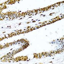 Invitrogen NFkB p100 Polyclonal Antibody 100 &mu;L; Unconjugated:Antibodies,