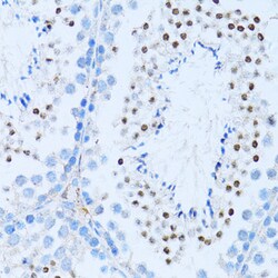 Invitrogen NFkB p100 Polyclonal Antibody 100 &mu;L; Unconjugated:Antibodies,