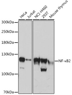 Invitrogen NFkB p100 Polyclonal Antibody 100 &mu;L; Unconjugated:Antibodies,