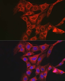Invitrogen PACAP Receptor Polyclonal Antibody 100 &mu;L; Unconjugated:Antibodies,