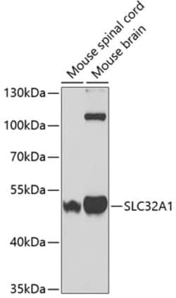 Invitrogen VGAT Polyclonal Antibody 100 &mu;L; Unconjugated:Antibodies,
