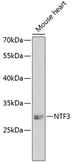 Invitrogen NTF3 Polyclonal Antibody 100 &mu;L; Unconjugated:Antibodies,