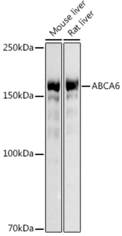 Invitrogen ABCA6 Polyclonal Antibody 100 &mu;L; Unconjugated:Antibodies,