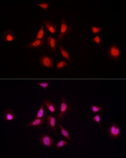 Invitrogen NFIA Polyclonal Antibody 100 &mu;L; Unconjugated:Antibodies,