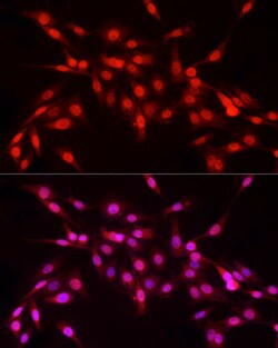 Invitrogen NFIA Polyclonal Antibody 100 &mu;L; Unconjugated:Antibodies,