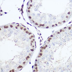 Invitrogen NFIA Polyclonal Antibody 100 &mu;L; Unconjugated:Antibodies,