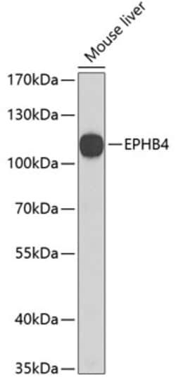 Invitrogen EphB4 Polyclonal Antibody 100 &mu;L; Unconjugated:Antibodies,
