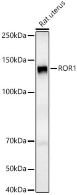 Invitrogen ROR1 Polyclonal Antibody 100 &mu;L; Unconjugated:Antibodies,