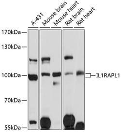 Invitrogen IL1RAPL1 Polyclonal Antibody 100 &mu;L; Unconjugated:Antibodies,