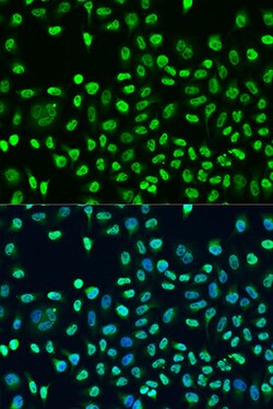 Invitrogen STAU2 Polyclonal Antibody 100 μL; Unconjugated:Antibodies,