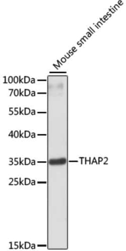 Invitrogen THAP2 Polyclonal Antibody 100 &mu;L; Unconjugated:Antibodies,