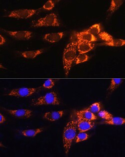 Invitrogen AMPD1 Polyclonal Antibody 100 &mu;L; Unconjugated:Antibodies,