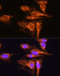 Invitrogen AMPD1 Polyclonal Antibody 100 &mu;L; Unconjugated:Antibodies,