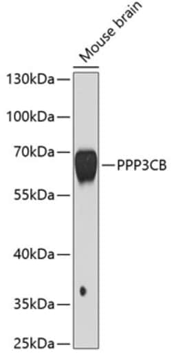 Invitrogen PPP3CB Polyclonal Antibody 100 &mu;L; Unconjugated:Antibodies