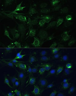 Invitrogen COX6A1 Polyclonal Antibody 100 &mu;L; Unconjugated:Antibodies,